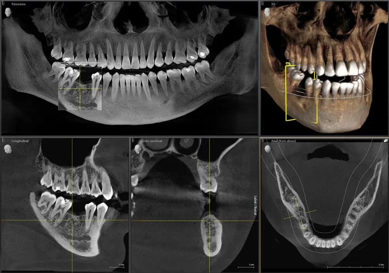 3D X-ray image